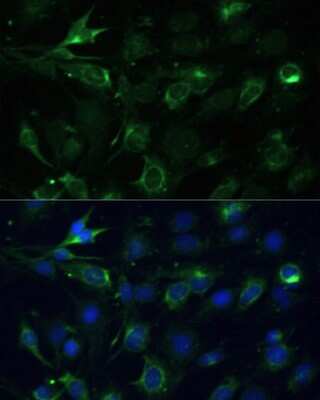 Immunocytochemistry/ Immunofluorescence: COX6A1 Antibody - BSA Free [NBP2-92889]