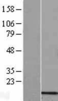 Western Blot: COX6B2 Overexpression Lysate [NBL1-09417]