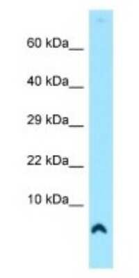 Western Blot: COX7A1 Antibody [NBP1-98535]