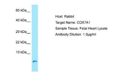 Western Blot: COX7A1 Antibody [NBP1-98536]