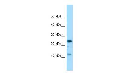 Western Blot: COX7A2 Antibody [NBP3-10697]