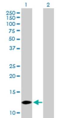 Western Blot: COX7A2L Antibody [H00009167-B01P]