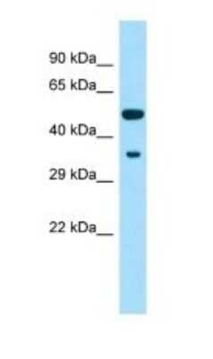 Western Blot: CP2F2 Antibody [NBP1-98269]