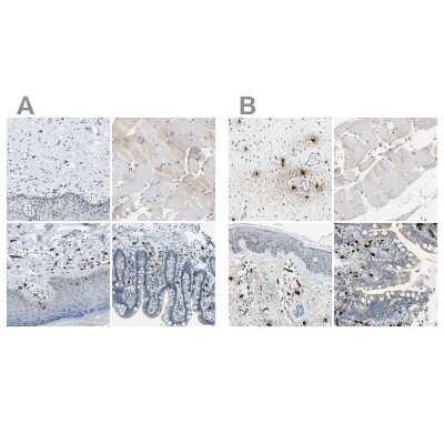 Immunohistochemistry-Paraffin: CPA3 Antibody [NBP1-86130]