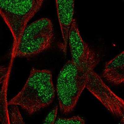 Immunocytochemistry/ Immunofluorescence: CPA5 Antibody [NBP1-91807]