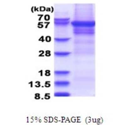SDS-PAGE: Recombinant Human CPEB1 His Protein [NBP2-51672]