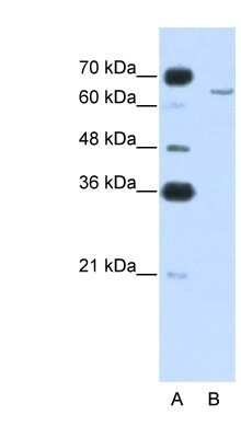 Western Blot: CPEB2 Antibody [NBP1-57416]