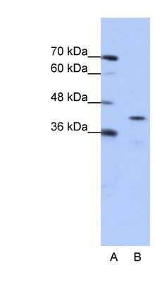 Western Blot: CPEB2 Antibody [NBP1-57459]