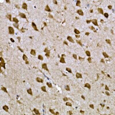 Immunohistochemistry-Paraffin: CPEB3 Antibody - Azide and BSA Free [NBP2-92754]