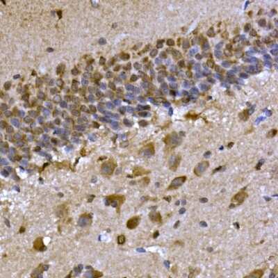 Immunohistochemistry-Paraffin: CPEB3 Antibody - Azide and BSA Free [NBP2-92754]