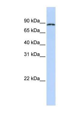 Western Blot: CPEB4 Antibody [NBP1-80468]
