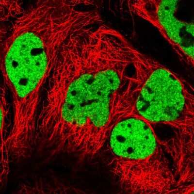 Immunocytochemistry/ Immunofluorescence: CPI17 alpha Antibody [NBP2-58619]