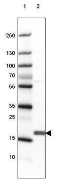 Western Blot: CPI17 alpha Antibody [NBP2-37897]