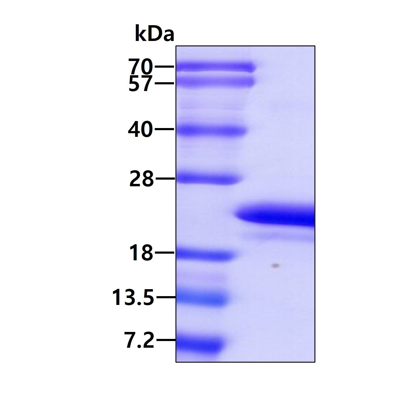 SDS-PAGE: Recombinant Human CPI17 alpha His Protein [NBC1-18402]