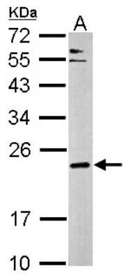 Western Blot: CPLX3 Antibody [NBP2-15985]