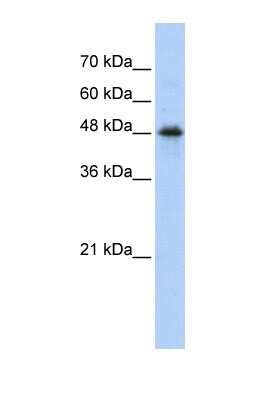 Western Blot: CPN1 Antibody [NBP1-57960]