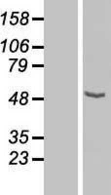 Western Blot: CPN1 Overexpression Lysate [NBL1-09440]