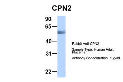 Western Blot: CPN2 Antibody [NBP2-82751]
