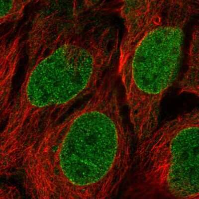 Immunocytochemistry/ Immunofluorescence: CPNE1 Antibody [NBP2-54980]
