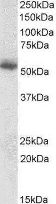 Western Blot: CPNE1 Antibody [NBP1-51952]