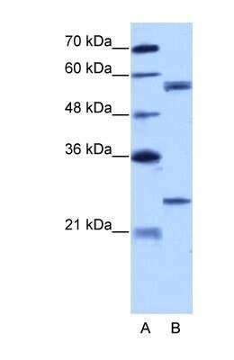 Western Blot: CPNE1 Antibody [NBP1-57418]