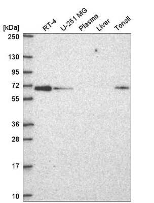 Western Blot: CPNE1 Antibody [NBP2-57519]