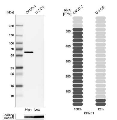 Western Blot: CPNE1 Antibody [NBP2-57519]