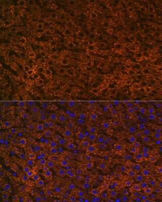 Immunohistochemistry: CPS1 Antibody (1R6W3) [NBP3-16357]