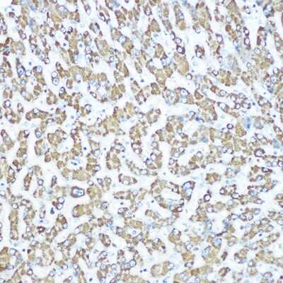 Immunohistochemistry-Paraffin: CPS1 Antibody (1R6W3) [NBP3-16357]