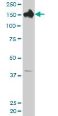 Western Blot: CPS1 Antibody (4A10) [H00001373-M02]