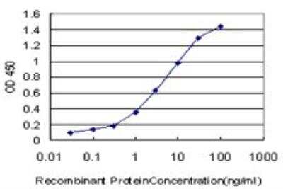 ELISA: CPS1 Antibody (8H8) [H00001373-M01]