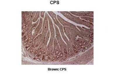 Immunohistochemistry: CPS1 Antibody [NBP1-54775]