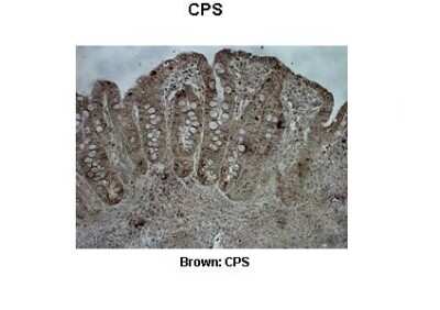 Immunohistochemistry: CPS1 Antibody [NBP1-54775]