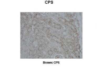 Immunohistochemistry: CPS1 Antibody [NBP1-54775]