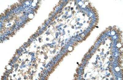 Immunohistochemistry-Paraffin: CPS1 Antibody [NBP1-54774]