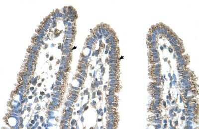 Immunohistochemistry-Paraffin: CPS1 Antibody [NBP1-54775]