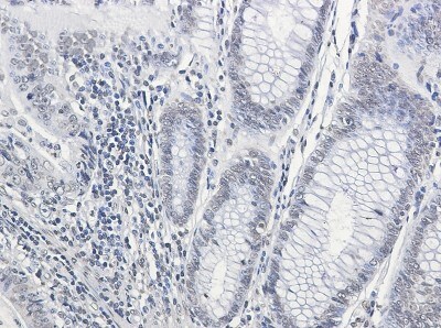 Immunohistochemistry-Paraffin: CPS1 Antibody (S01-2A0) [NBP3-19851]