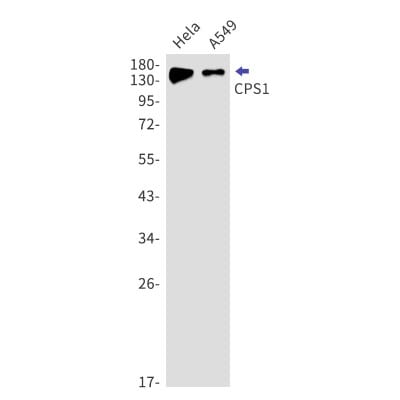 Western Blot: CPS1 Antibody (S01-2A0) [NBP3-19851]