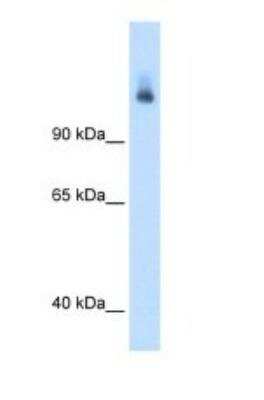 Western Blot: CPS1 Antibody [NBP1-54774]
