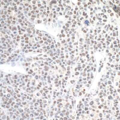 Immunohistochemistry-Paraffin: CPSF1 Antibody [NB100-79822]