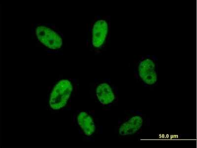 Immunocytochemistry/ Immunofluorescence: CPSF2 Antibody [H00053981-B01P]