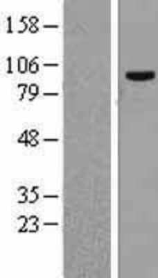 Western Blot: CPSF2 Overexpression Lysate [NBL1-09446]