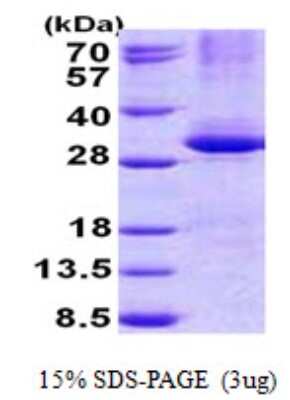 SDS-PAGE: Recombinant Human CPSF4 His Protein [NBP2-22783]