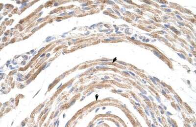 Immunohistochemistry-Paraffin: CPSF6 Antibody [NBP1-57541]