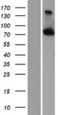 Western Blot: CPSF73 Overexpression Lysate [NBP2-07071]