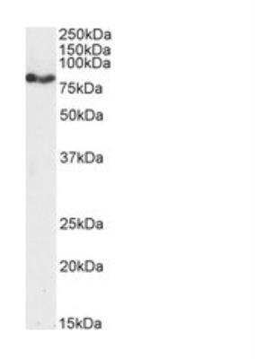 Western Blot: CPT1A Antibody [NB100-53791]