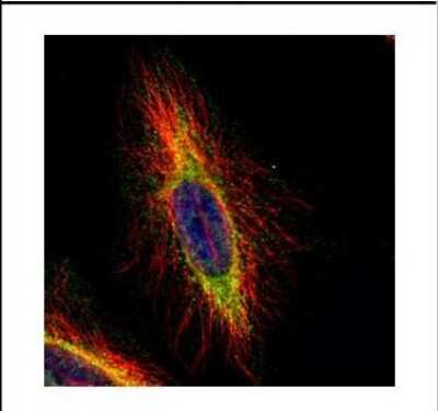 Immunocytochemistry/ Immunofluorescence: CPT1B Antibody [NBP2-15994]