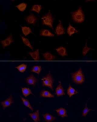 Immunocytochemistry/ Immunofluorescence: CPT1C Antibody - Azide and BSA Free [NBP2-92133]