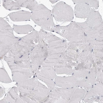 Immunohistochemistry-Paraffin: CPT2 Antibody [NBP1-85471]