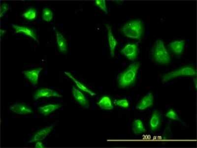 Immunocytochemistry/ Immunofluorescence: CPVL Antibody (2G5-1C1) [H00054504-M01]